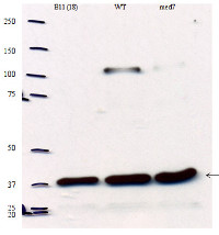 Med 6 | Mediator of RNA polymerase II transcription subunit 6 in the group Antibodies for Plant/Algal / DNA/RNA/Cell Cycle / Transcription regulation at Agrisera AB (Antibodies for research) (AS14 2802)